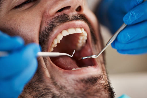 Best After-Hours Emergency Dentist in Mcconnelsville, OH